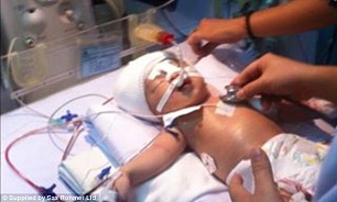 حمله وحشیانه یک بیمار به نوزاد 11 روزه با چاقو/ کودک بی‌گناه یک چشمش را از دست داد