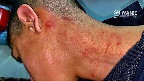 انجام ۹ عملیات مقاومتی در کرانه باختری/ شهادت جوان فلسطینی انجام ۹ عملیات مقاومتی در کرانه باختری/ شهادت جوان فلسطینی