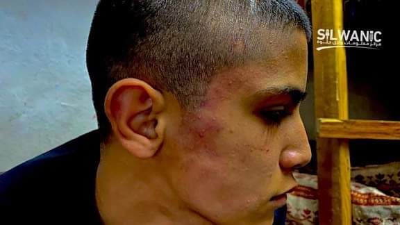 انجام ۹ عملیات مقاومتی در کرانه باختری/ شهادت جوان فلسطینی انجام ۹ عملیات مقاومتی در کرانه باختری/ شهادت جوان فلسطینی